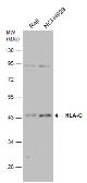 Anti-HLA-G antibody used in Western Blot (WB). GTX112713