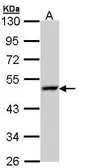 Anti-LAMP3 antibody used in Western Blot (WB). GTX112715