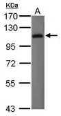 Anti-LILRB1 antibody [N1C1] used in Western Blot (WB). GTX112718