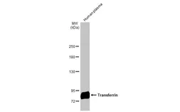 Anti-Transferrin antibody [N3C2], Internal used in Western Blot (WB). GTX112729