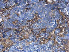 Anti-COL1A1 antibody [N1N2], N-term used in IHC (Paraffin sections) (IHC-P). GTX112731