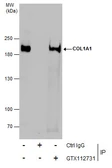 Anti-COL1A1 antibody [N1N2], N-term used in Immunoprecipitation (IP). GTX112731