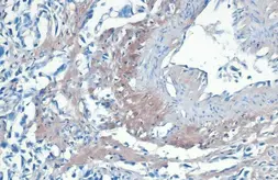 Anti-COL1A1 antibody [N1N2], N-term used in IHC (Paraffin sections) (IHC-P). GTX112731