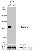 Anti-N-Cadherin antibody [N1N3] used in Western Blot (WB). GTX112734