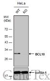 Anti-BCL10 antibody used in Western Blot (WB). GTX112744