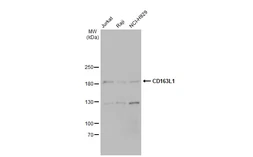 Anti-CD163L1 antibody [N1N2], N-term used in Western Blot (WB). GTX112752
