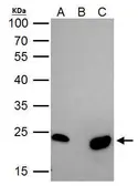 Anti-mtTFA antibody used in Immunoprecipitation (IP). GTX112760