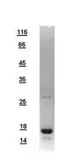 Human Parathyroid Hormone protein, His tag. GTX112768-pro