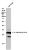 Anti-Cardiac Troponin I antibody [N1C3-2] used in Western Blot (WB). GTX112770