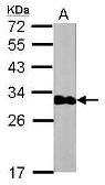 Anti-Cardiac Troponin I antibody [N1C3-2] used in Western Blot (WB). GTX112770