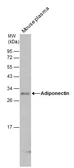 Anti-Adiponectin antibody used in Western Blot (WB). GTX112777