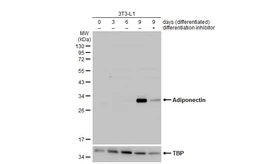 Anti-Adiponectin antibody used in Western Blot (WB). GTX112777