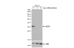 Anti-UCP1 antibody used in Western Blot (WB). GTX112784