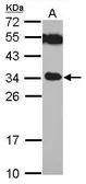 Anti-TICAM2 antibody used in Western Blot (WB). GTX112785