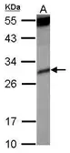 Anti-KIR2DS4 antibody [N1C3-2] used in Western Blot (WB). GTX112787