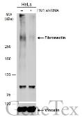 Anti-Fibronectin antibody [N1N2], N-term used in Western Blot (WB). GTX112794