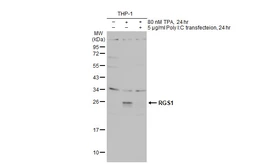 Anti-RGS1 antibody used in Western Blot (WB). GTX112803