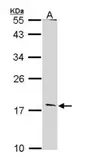 Anti-Glucagon antibody [N1C3-2] used in Western Blot (WB). GTX112806