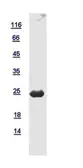 Human RGS5 protein, His tag. GTX112807-pro
