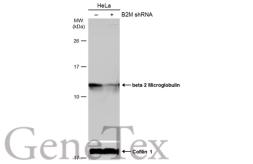 Anti-beta 2 Microglobulin antibody used in Western Blot (WB). GTX112815