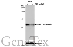 Anti-beta 2 Microglobulin antibody used in Western Blot (WB). GTX112815