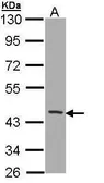 Anti-CD1b antibody [N2C3] used in Western Blot (WB). GTX112817