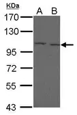 Anti-FcRH5 antibody [N2N3] used in Western Blot (WB). GTX112819