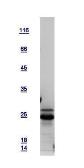 Human GADD153 protein, His tag. GTX112827-pro