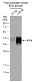 Anti-EPO antibody used in Western Blot (WB). GTX112833