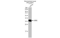 Anti-EPO antibody used in Western Blot (WB). GTX112834
