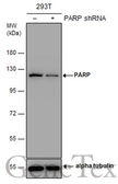 Anti-PARP antibody [N1N2], N-term used in Western Blot (WB). GTX112839