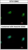 Anti-CDK4 antibody used in Immunocytochemistry/ Immunofluorescence (ICC/IF). GTX112842