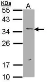 Anti-ERCC1 antibody [N1C3-2] used in Western Blot (WB). GTX112848