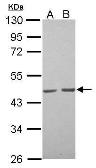 Anti-alpha Skeletal Muscle Actin antibody used in Western Blot (WB). GTX112860