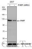 Anti-PARP antibody [N2C1], Internal used in Western Blot (WB). GTX112864