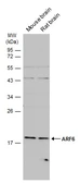 Anti-ARF6 antibody [N1C3] used in Western Blot (WB). GTX112872