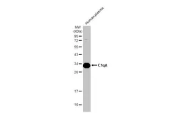 Anti-C1qA antibody used in Western Blot (WB). GTX112883