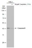 Anti-Caspase 9 antibody [N2C3] used in Western Blot (WB). GTX112888