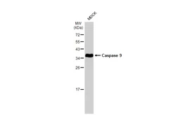 Anti-Caspase 9 antibody [N2C3] used in Western Blot (WB). GTX112888