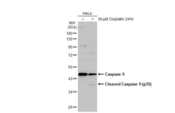 Anti-Caspase 9 antibody [N2C3] used in Western Blot (WB). GTX112888