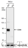 Anti-CD44 antibody [N1N2], N-term used in Western Blot (WB). GTX112893