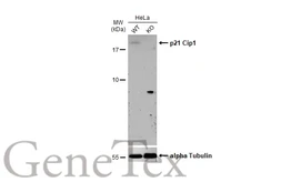 Anti-p21 Cip1 antibody used in Western Blot (WB). GTX112898
