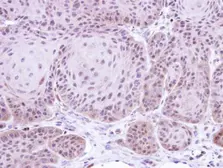 Anti-Daxx antibody [N1N3] used in IHC (Paraffin sections) (IHC-P). GTX112908