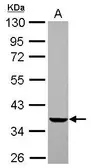 Anti-EDG2 antibody used in Western Blot (WB). GTX112916