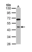 Anti-ERG antibody [N2C2], Internal used in Western Blot (WB). GTX112926