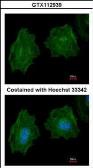 Anti-Filamin A antibody [C2], C-term used in Immunocytochemistry/ Immunofluorescence (ICC/IF). GTX112939