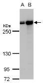 Anti-Filamin A antibody [C2], C-term used in Western Blot (WB). GTX112939