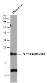 Anti-Ferritin Light Chain antibody [N1C3-3] used in Western Blot (WB). GTX112943