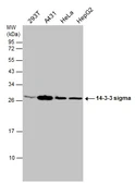Anti-14-3-3 sigma antibody [N1C3-2] used in Western Blot (WB). GTX112949