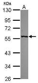Anti-GPT antibody [N2C2], Internal used in Western Blot (WB). GTX112952
